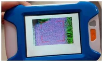 Garbled display. The source identifies an abnormal, garbled screen image.